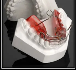 The Bionator: A Versatile Appliance for Class II Correction Through Mandibular Translation — Michael Hansen